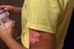 Menina foi dopada, queimada com ferro e obrigada a tomar açaí com urina