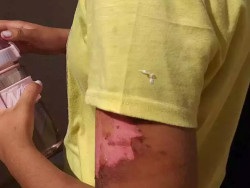 Menina foi dopada, queimada com ferro e obrigada a tomar açaí com urina