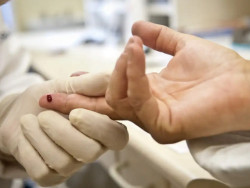 Casos de sífilis e de HIV/aids aumentam entre homens jovens