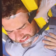 A dois dias de show em Dourados, Zé Neto sofre acidente em Minas