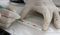 Cresce casos de Covid e MS registra 1,7 notificações em 2024