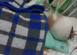 Bebê espancado por mãe e padrasto morre em Campo Grande