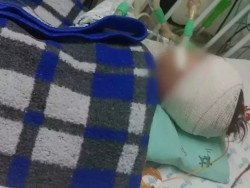 Bebê espancado por mãe e padrasto morre em Campo Grande