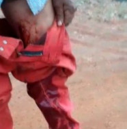 Indígena é baleado na perna em nova onda de ocupações de terra