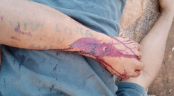 Ataque a tiros deixa cinco indígenas feridos em área de conflito