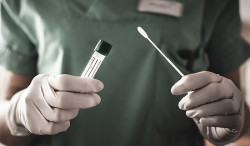 Centro de Testagem da Covid entra em operação com cinco mil testes rápidos