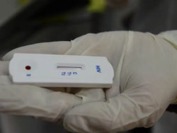 Transplantados do RJ testam positivo para HIV após receberem órgão infectado