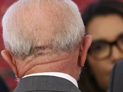 Presidente Lula recebe liberação médica para viajar de avião