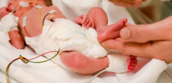 Taxa de nascimentos prematuros do Brasil está acima da média global