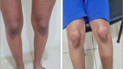 Mulheres são presas por torturarem criança e adolescente em cidade de MS