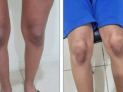 Mulheres são presas por torturarem criança e adolescente em cidade de MS