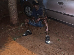 Homem é socorrido em estado grave após sofrer queimaduras em Dourados