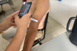 Saúde implanta telediagnóstico de dermatologia e capacita profissionais em MS