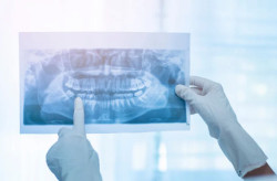 Saúde auxilia na compra de raio-X panorâmico para equipar municípios