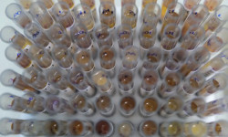 Casos de malária no Brasil caem 26% no primeiro trimestre de 2025