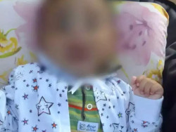 Bebê de 6 meses morre após apresentar hematoma na cabeça e sangramento no nariz
