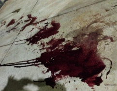 Ladrão que manteve família refém é baleado e preso; comparsa morre em confronto