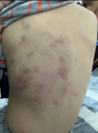 Mãe sai para trabalhar e filho de 3 anos é espancado pelo padrasto; autor está preso