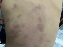 Mãe sai para trabalhar e filho de 3 anos é espancado pelo padrasto; autor está preso