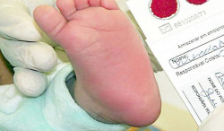 MS lança plano de trabalho para reforçar linha de cuidado e ampliar diagnóstico