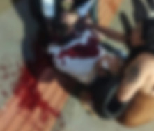 Homem fica em estado grave após ser baleado 4 vezes no centro de Dourados