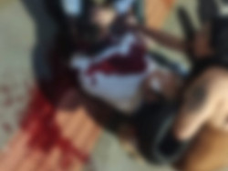 Homem fica em estado grave após ser baleado 4 vezes no centro de Dourados