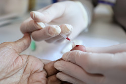 Saúde de Dourados reforça ações de prevenção e diagnóstico das hepatites virais