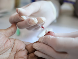 Saúde de Dourados reforça ações de prevenção e diagnóstico das hepatites virais