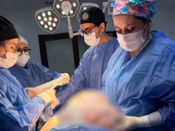 Mulher passa por cirurgia para para remover tumor ovariano de 11 quilos em Pedro Juan