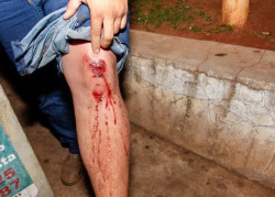 Guarda municipal agride paciente ao ser xingado em UPA da Capital