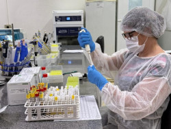 MS lidera o país em testagens e se torna referência em vigilância laboratorial e epidemiológica