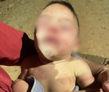 Mãe sai para trabalhar e pai espanca bebê de apenas 4 meses na Capital