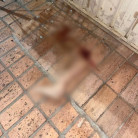 Mulher é atropelada e perna da vítima é encontrada a 50 metros do local do acidente