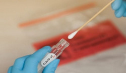 MS volta a registrar mortes por Covid-19