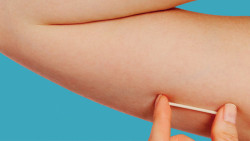 HU realiza mutirão com DIU e Implanon, mas atendimento seguirá critérios médicos