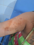 Mulher é ferida com faca e agressor preso em Dourados