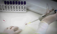 Paciente em SP com suspeita de ebola testa positivo para meningite