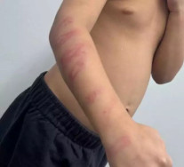 Homem é preso após espancar enteado de 5 anos com galho de amora na Capital