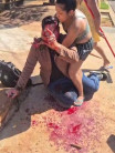 Jornalista é agredido por trio após deixar evento municipal em Três Lagoas