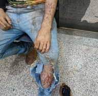Com arranhões, operador de colheitadeira diz que foi atacado por onça em lavoura