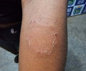 Após várias ligações, polícia prende homem que enforcou e mordeu mulher