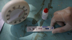 MS recebeu mais de R$ 402 milhões do Governo Federal para ações contra a Covid-19