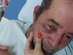 Apaniguado de prefeito espanca agricultor em bar de Vicentina