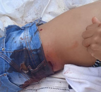 Polícia Federal vai a local de confronto com 9 feridos na fronteira