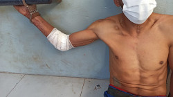 Ao tentar furtar telhado de zinco, homem cai e fica machucado