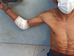 Ao tentar furtar telhado de zinco, homem cai e fica machucado