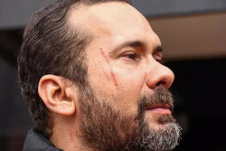 Candidato esfaqueado diz que amante tem "prática de agredir"