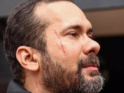 Candidato esfaqueado diz que amante tem "prática de agredir"