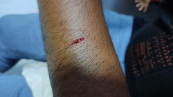 Acusada de matar homem a facada é detida novamente após esfaquear outro