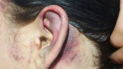 ‘Não teve a intenção de matar’: farmacêutico é absolvido depois de torturar e estuprar ex